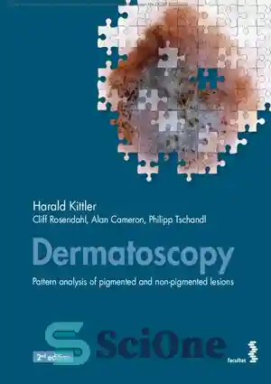 دانلود کتاب Dermatoscopy – Pattern analysis of pigmented and non ...