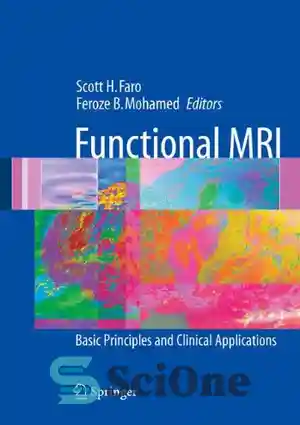 دانلود کتاب Functional MRI Basic Principles and Clinical Applications ...